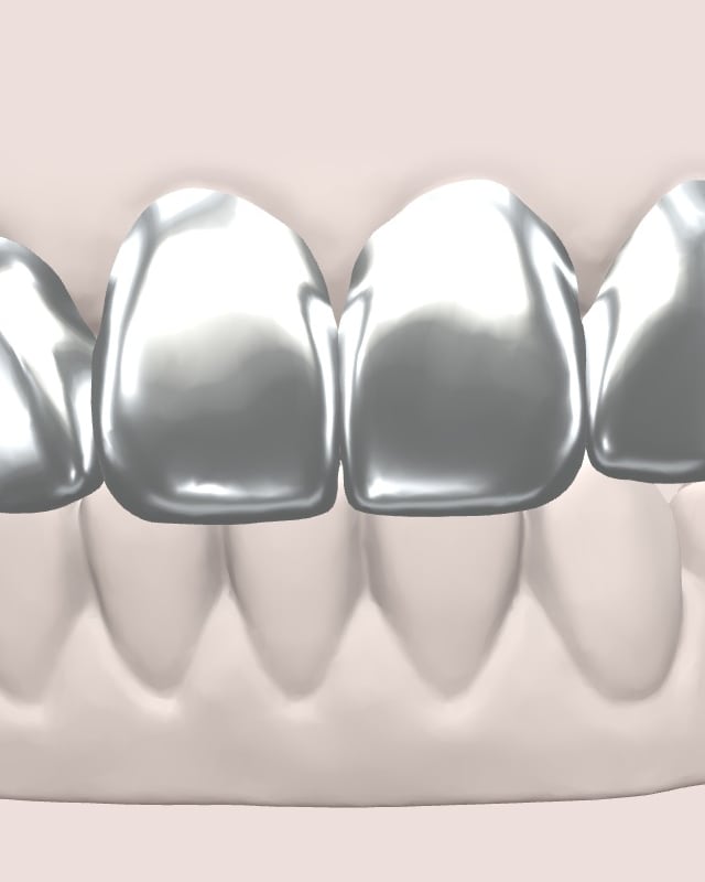 The same six teeth in 9K white gold