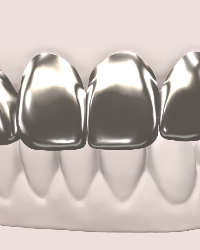 The same six teeth in silver